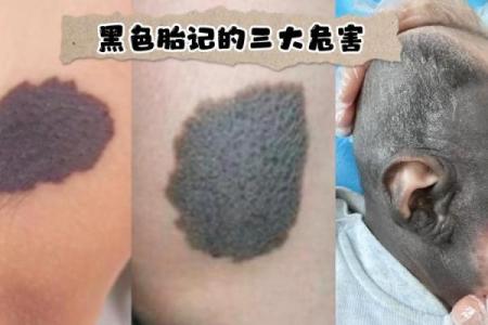 脸上各部位的胎记算命