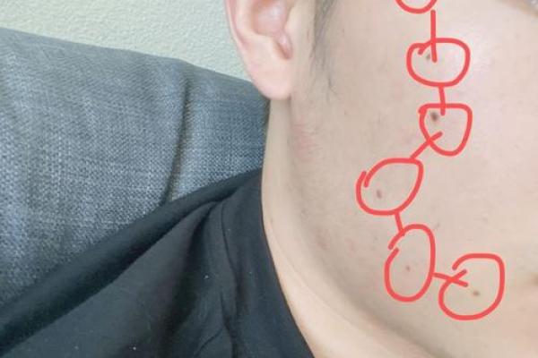 神仙下凡投胎的痣七星图 神仙投胎后身上的七颗神秘痣为何会排列成星座形状
