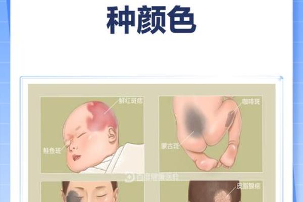 看胎记颜色类型算命