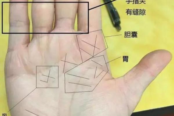 手指内侧长红胎记算命准吗