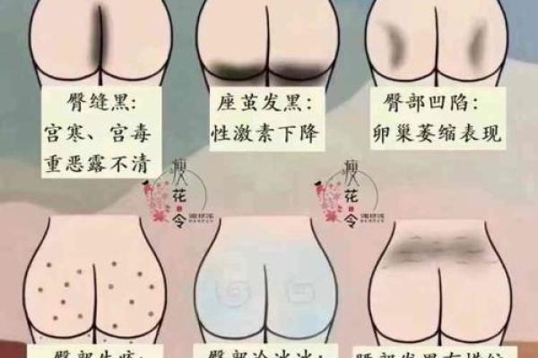 屁股有白斑风水