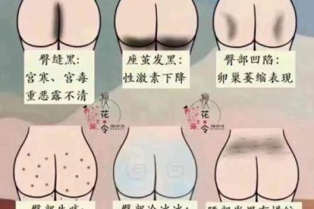 屁股有白斑风水